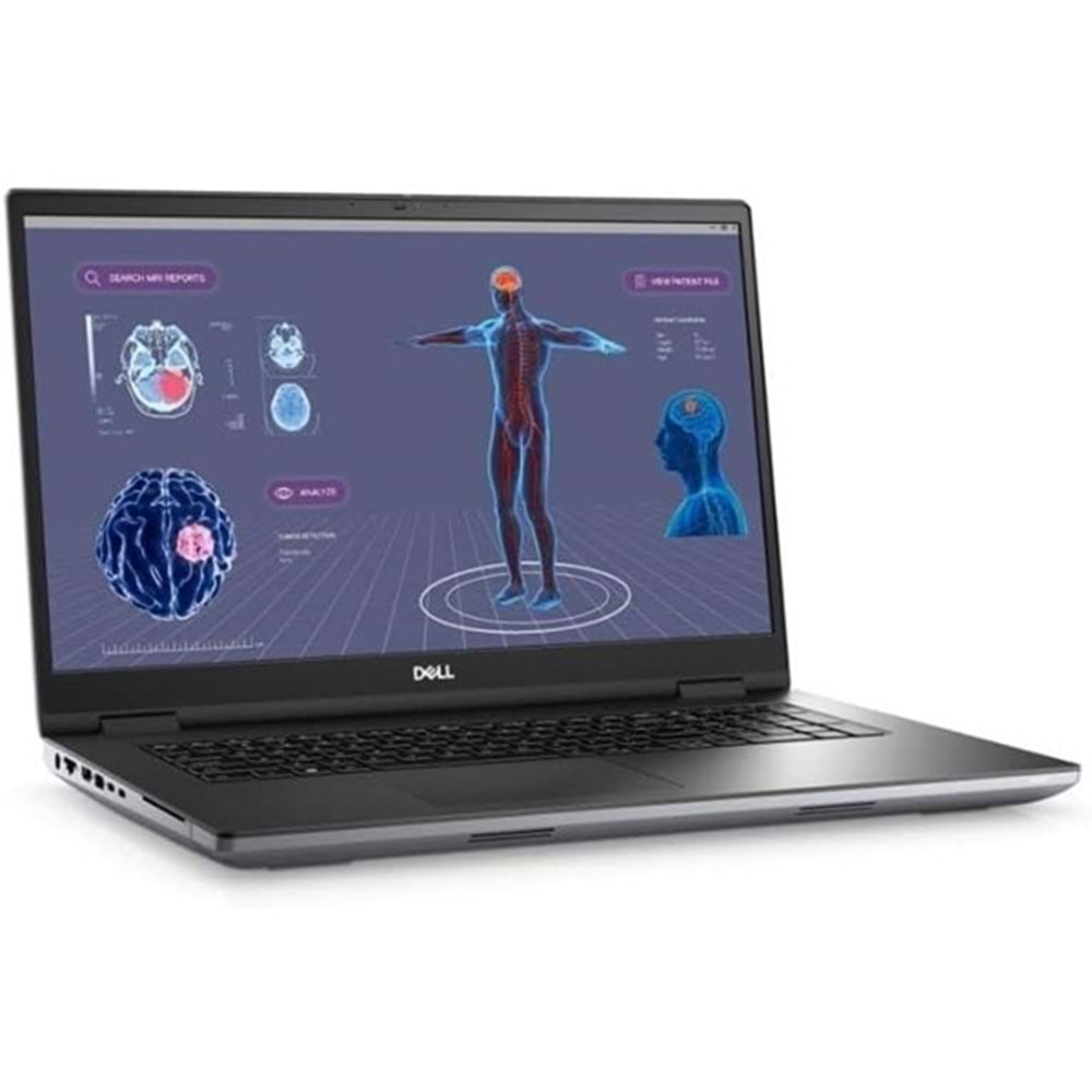 DELL 17.3