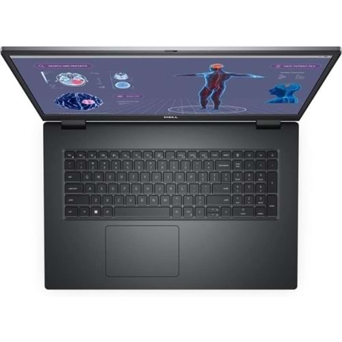 DELL 17.3